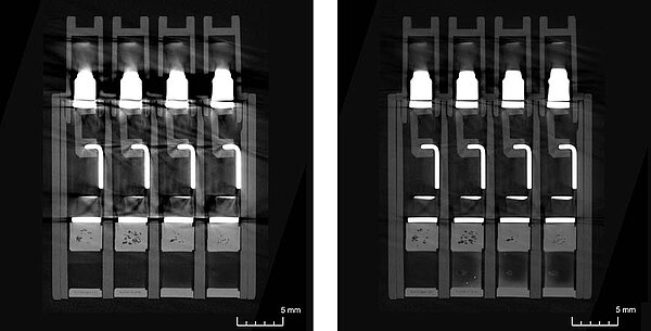 Multi-material artifact correction – Precision for the next generation